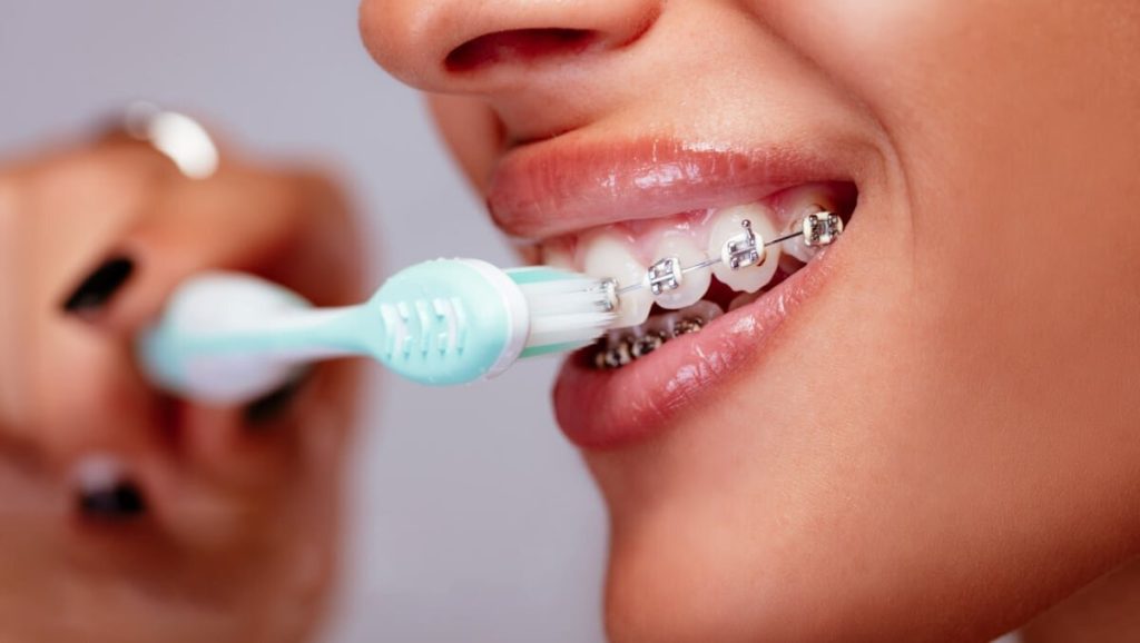 5 правил ухода за зубами